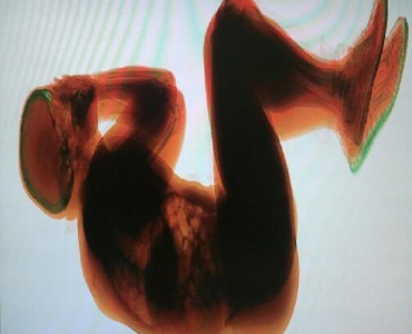 Rome Fiumicino Airport: xray